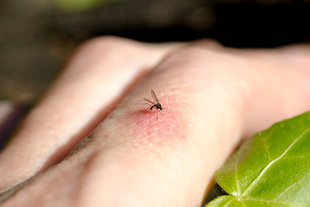 mosquito morder dedo - mosquito malaria parasite biting insect fotografías e imágenes de stock