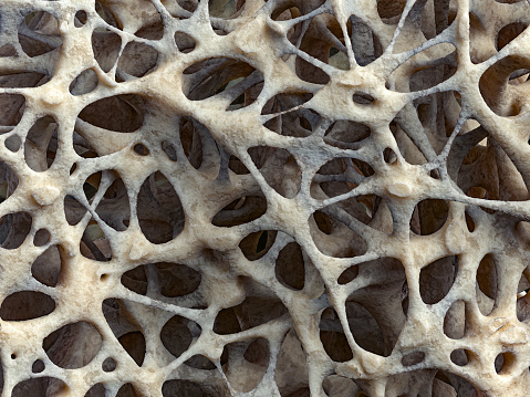 Realistic bone spongy structure close-up, bone texture affected by osteoporosis, 3d illustration. Bone tissue damaged by osteoporosis