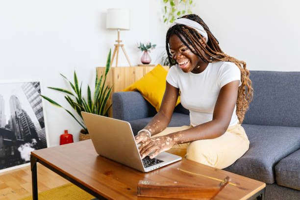 Young student woman with vitiligo studying on laptop sitting on sofa at home