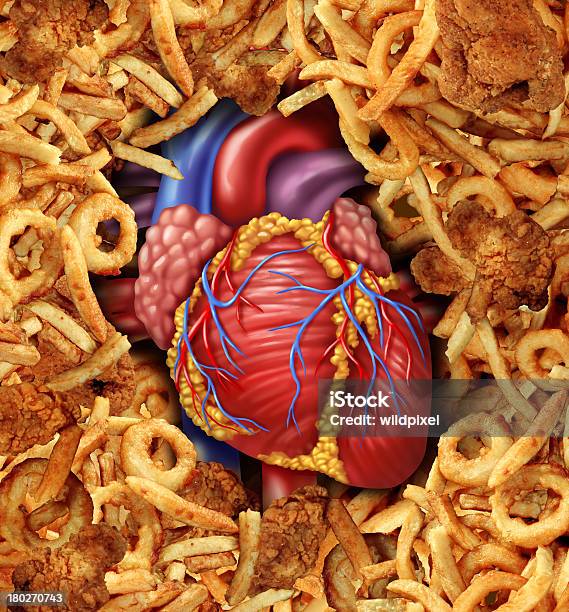 Photo libre de droit de Maladie Cardiovasculaire De banque d'images et plus d'images libres de droit de Acides gras trans - Acides gras trans, Alimentation lourde, Artère coronaire