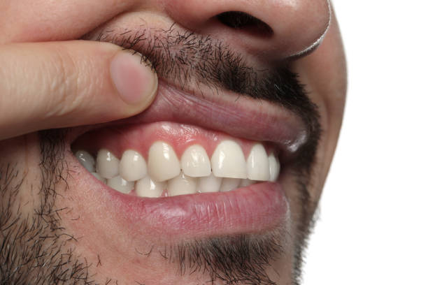 istock Man showing healthy gums on white background, closeup 1802822068