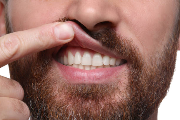 Man showing healthy gums on white background, closeup