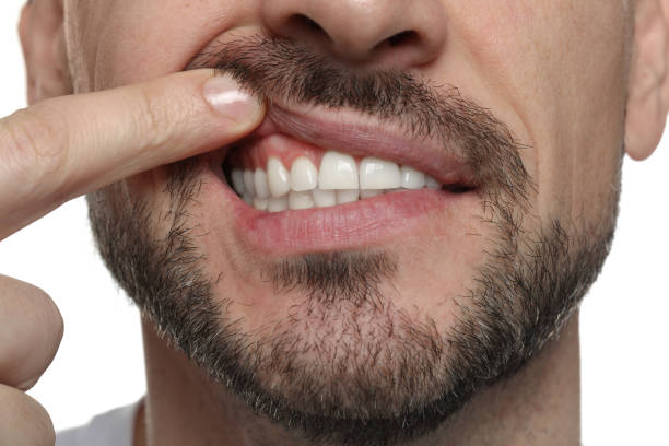 istock Man showing healthy gums on white background, closeup 1802827385