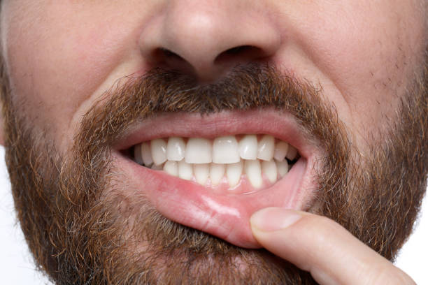 istock Man showing healthy gums on white background, closeup 1802827936