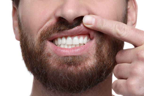 istock Man showing healthy gums on white background, closeup 1802828986