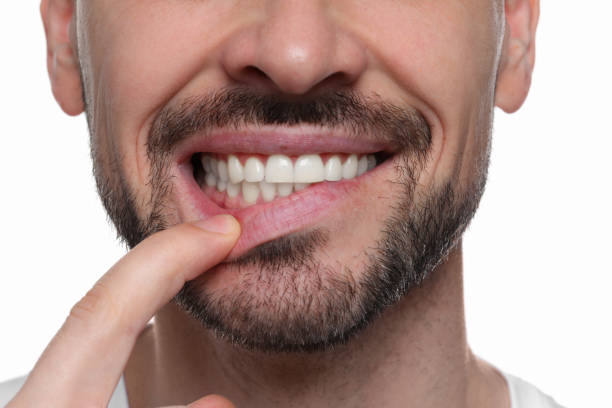 istock Man showing healthy gums on white background, closeup 1802831292