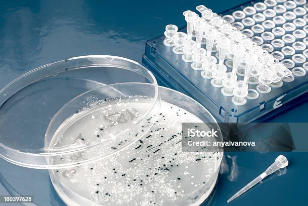 Colonie Batteriche Su Agar Piatto - Fotografie stock e altre immagini di Strumento PCR - Strumento PCR, Tubo, Tubo da laboratorio