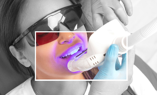 The dentist makes a teeth whitening procedure in the clinic to a young beautiful woman. A healthy smile.