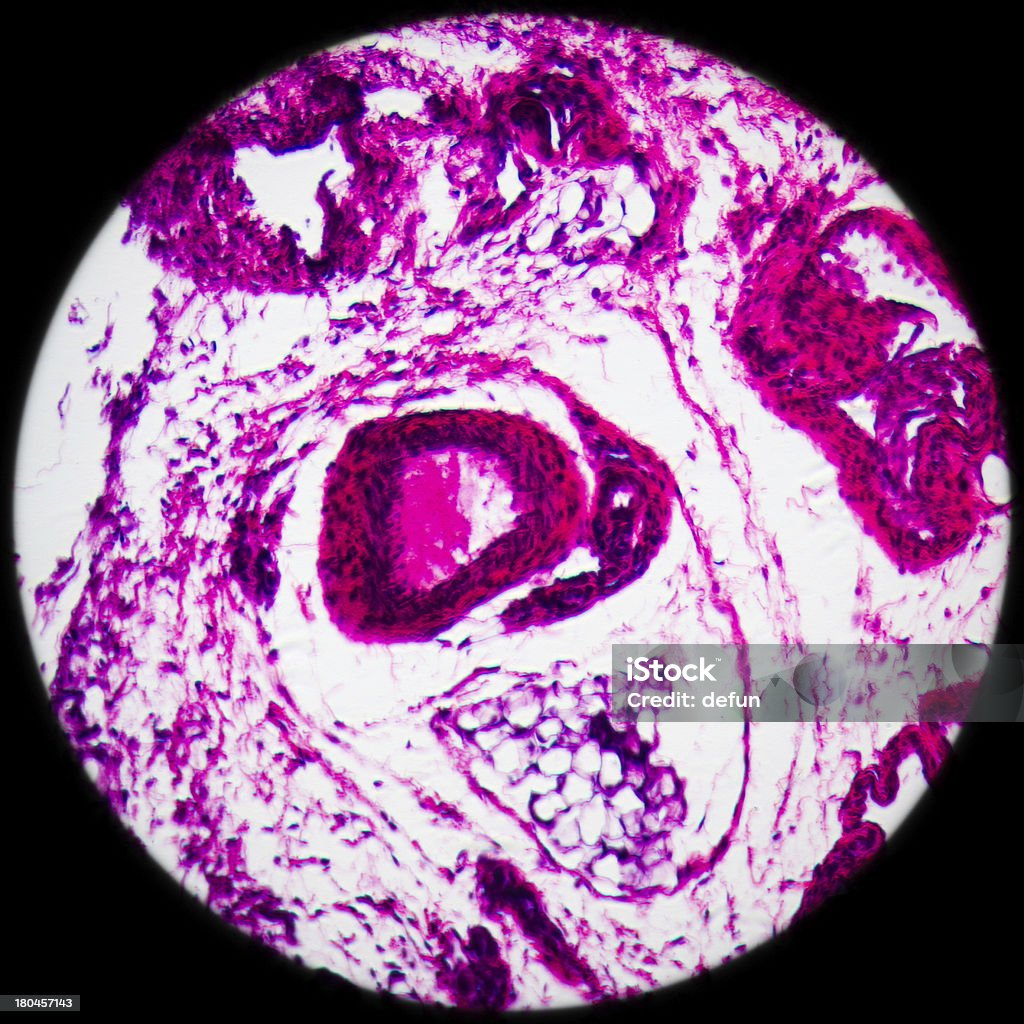 Lymphdrainage Drüse Gewebe - Lizenzfrei Anatomie Stock-Foto