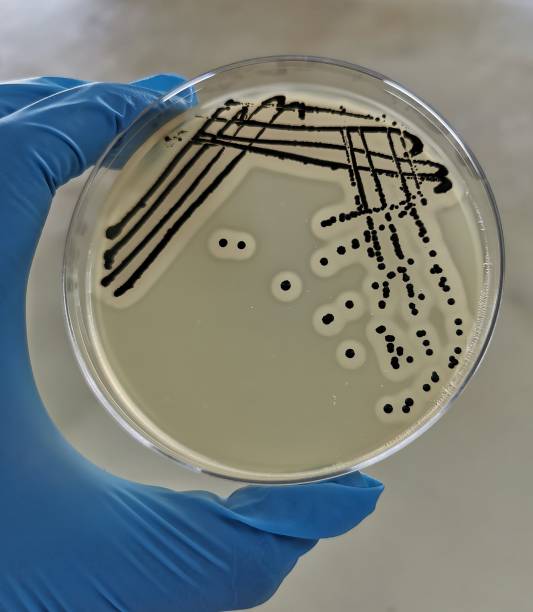 Staphylococcus aureus on Baird-Parker Agar A quadrant streak of the bacterium Staphylococcus aureus cultured or inoculated on Baird-Parker agar with egg tellurite . staphylococcal enterotoxicosis stock pictures, royalty-free photos & images