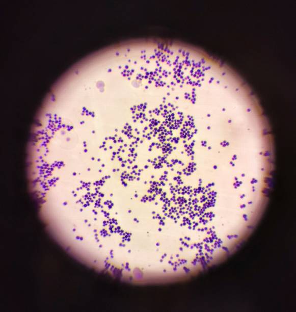 istock Gram Stain of Staphylococcus aureus 1804778774