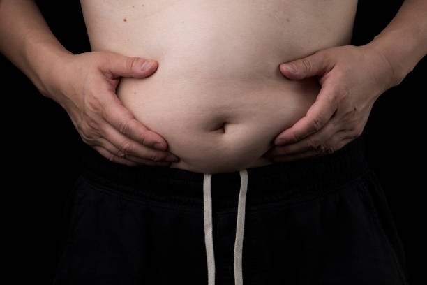 istock Overweight Middle-Aged Man with Belly 1805207832
