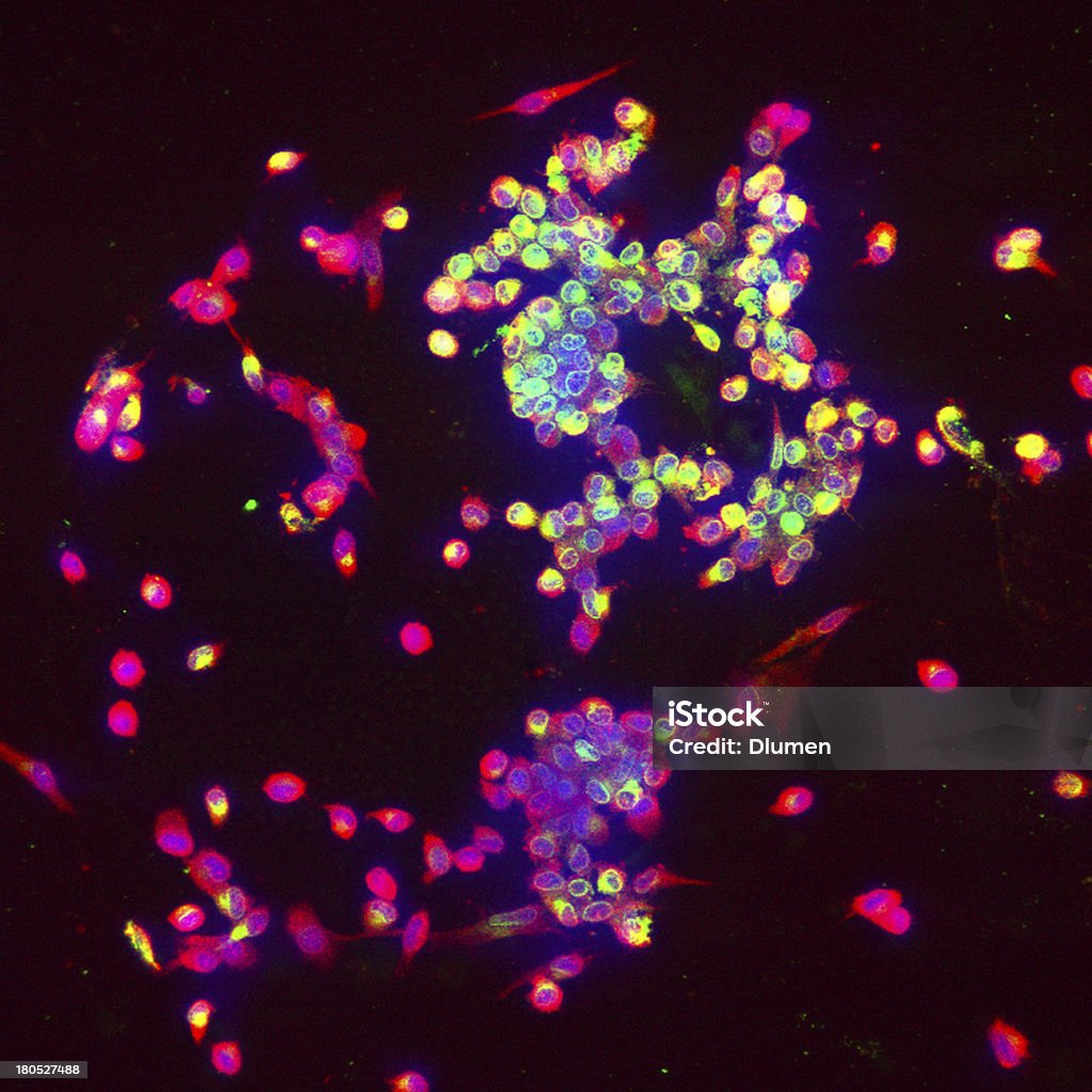 Células imunitárias a combater a infecção - Royalty-free Anticorpo Foto de stock