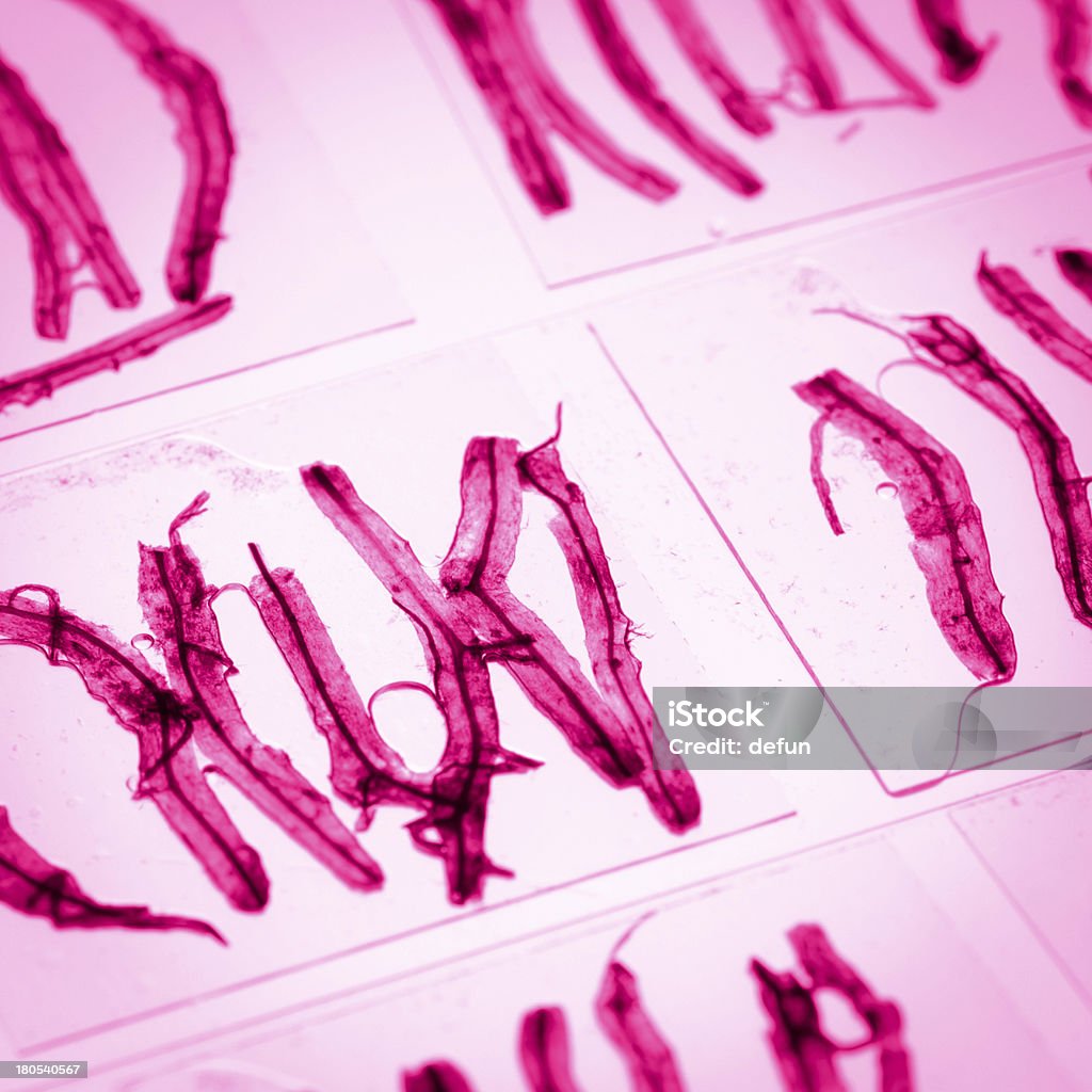 Scienza vetro Vetrino per microscopio con funghi impianto interno del tessuto - Foto stock royalty-free di Attrezzatura
