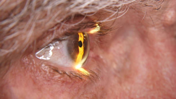 istock An elderly patient at an ophthalmologist's appointment. An ophthalmologist examines a client using a slit lamp in the office. Doctor doing an eye test using professional diagnostic equipment 1805502824