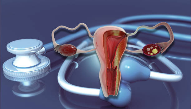 istock Uterus anatomy on stethoscope background 1805545304
