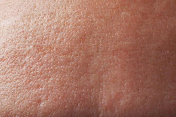 istock Closeup view of human skin as background 1806512270