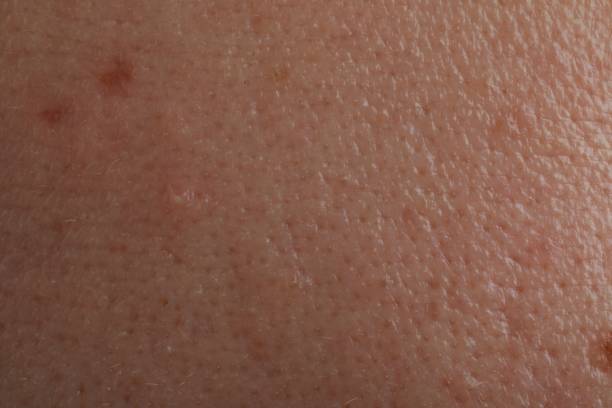 istock Closeup view of human skin as background 1806514140