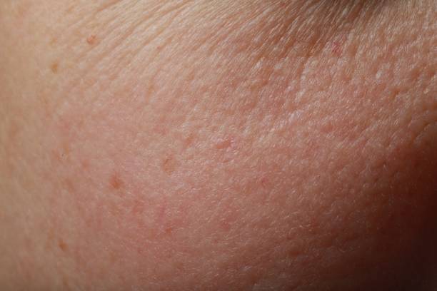 istock Closeup view of human skin as background 1806514679