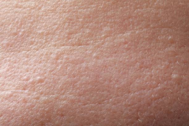 istock Closeup view of human skin as background 1806515202