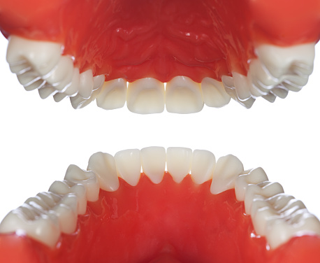 Close up of a dental implant model. Two stitched images, cropped white areas and downsized to achieve the best possible result.