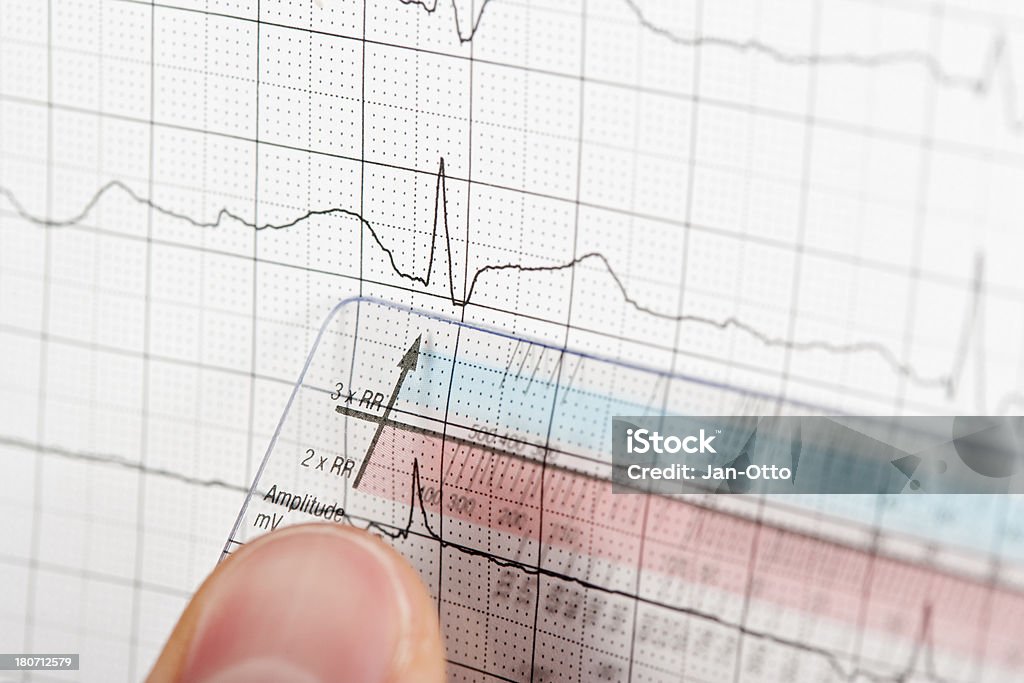 ECG Régua - Royalty-free Ouvir o Batimento Cardíaco Foto de stock