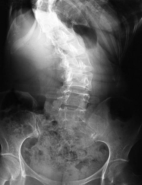 x 線画像の dogleg 人の内臓 - x ray human neck animal spine human spine ストックフォトと画像