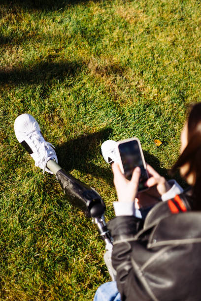 istock Young woman student with prosthetic leg sitting on green grass in university campus and using smartphone. Disabled woman with bionic leg in public park. Woman with prosthesis equipment using phone 1807426200