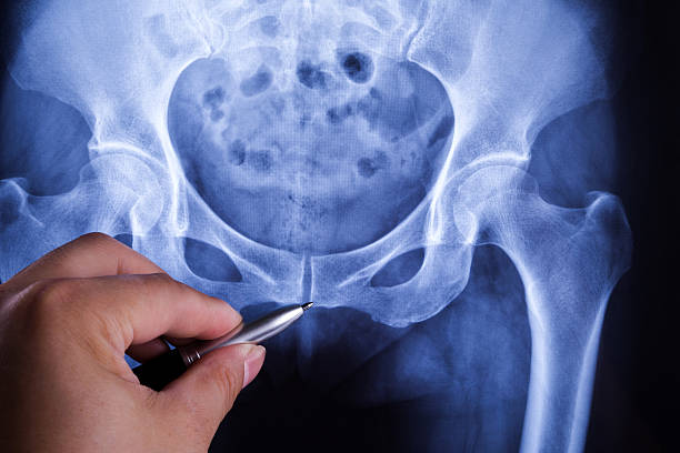 ヒト骨盤診断 x 線 - cat scan pelvis hip human spine ストックフォトと画像