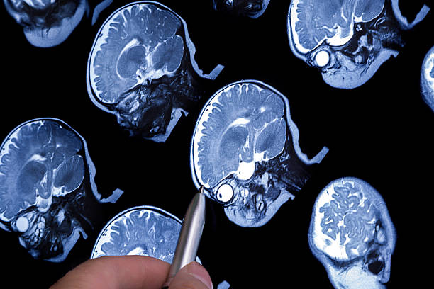 diagnozowania baby mri mózgu - nerve cell healthcare and medicine research human hand zdjęcia i obrazy z banku zdjęć