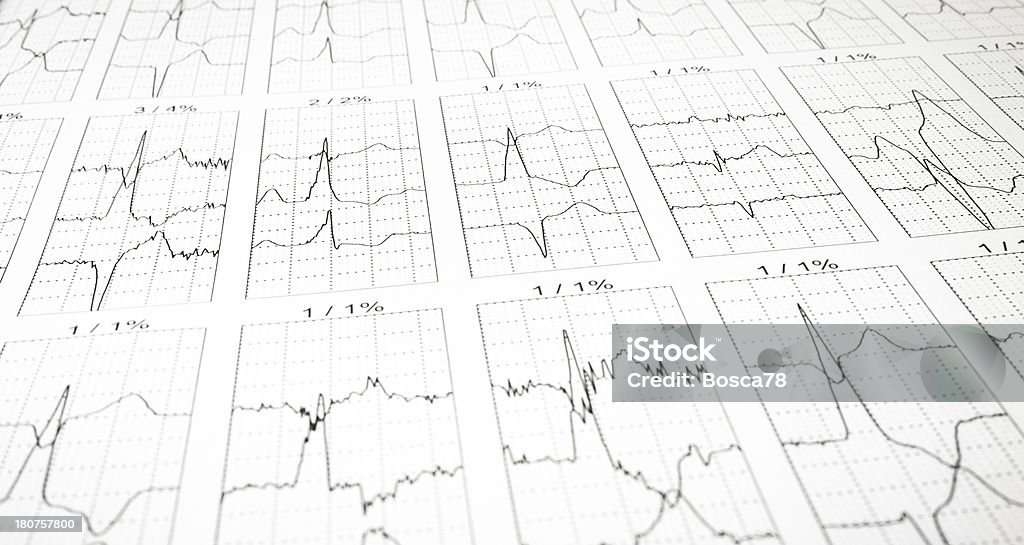 심박수 의학 인쇄 - 로열티 프리 건강관리와 의술 스톡 사진