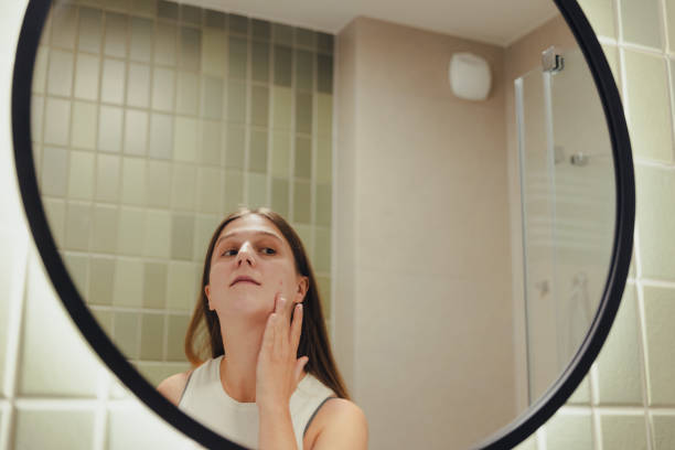 istock Woman Applying On Her Face Doing Acne Treatment in Bathroom 1807920543