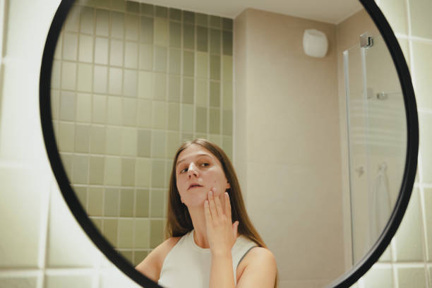 istock Woman Applying On Her Face Doing Acne Treatment in Bathroom 1807921678