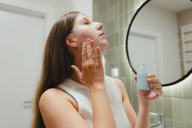 istock Woman Applying On Her Face Doing Acne Treatment in Bathroom 1807922251