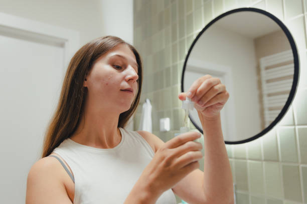 istock Woman Applying On Her Face Doing Acne Treatment in Bathroom 1807924025