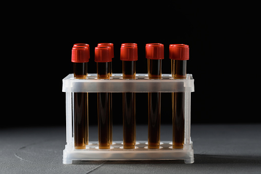 Test tubes with brown liquid in stand on grey table