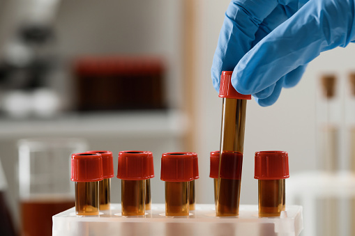 Scientist putting test tube with brown liquid into stand, closeup