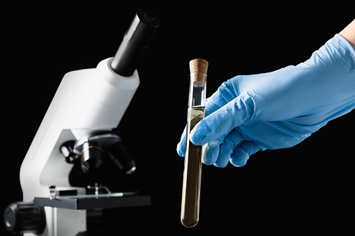 Scientist holding test tube with liquid against black background, closeup