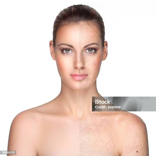 Before And After Stock Photo - Download Image Now - Before and After, Human Face, Females