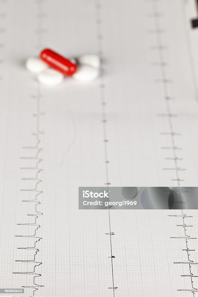 electrocardiogram (ECG) - Foto de stock de Arritmia cardíaca royalty-free