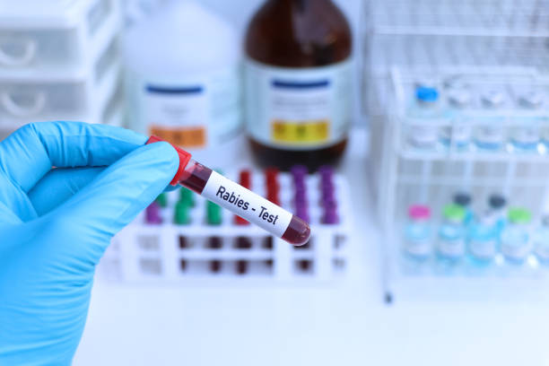 istock Rabies test to look for abnormalities from blood 1809617290
