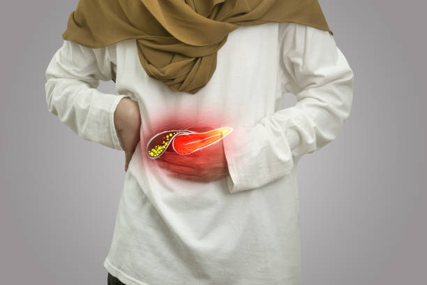 Digital composition of human gallbladder stone with highlighted red inflammation on sick person, woman with stomach pain, health and medical stock photo