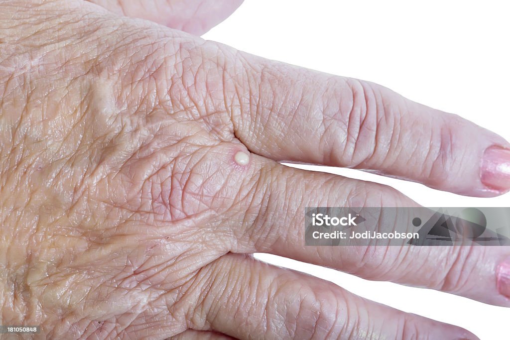 Formica spuntino di donna anziana a mano - Foto stock royalty-free di Formica