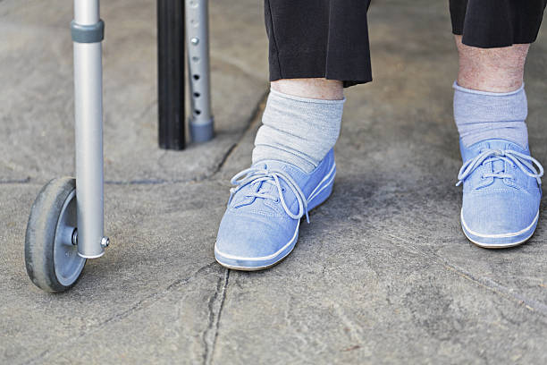 istock Senior Woman Swollen Ankles 181052903