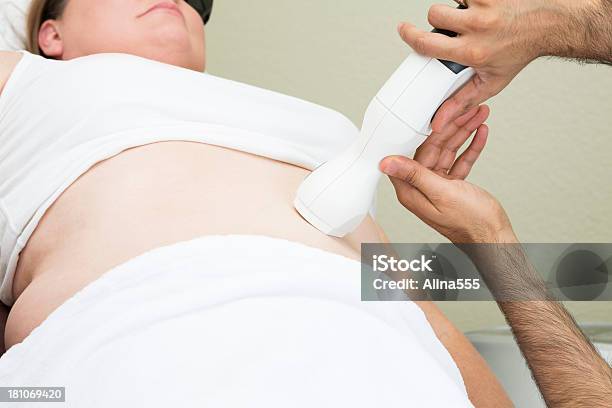 De Perda De Peso De Mulher A Fazer O Tratamento Com Laser No Salão De Médico - Fotografias de stock e mais imagens de Abdómen
