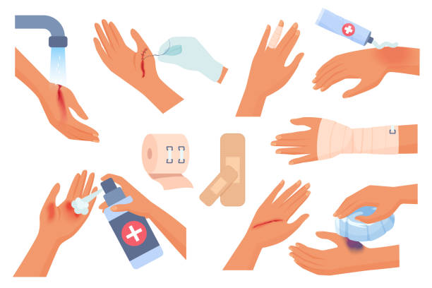 First aid for hand injury set, injured human arms of patient with wound and burn on skin First aid for hand injury set vector illustration. Cartoon isolated injured human arms of patient with wound and burn on skin, hands cleaning trauma with water, using elastic bandage and dressings putting on latex gloves stock illustrations