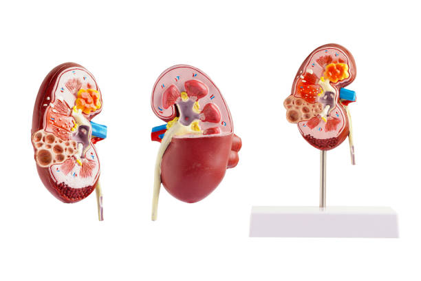 istock Kidney model isolated on white background Chronic kidney disease, treatment urinary system, urology, Estimated glomerular filtration rate eGFR. 1811280175