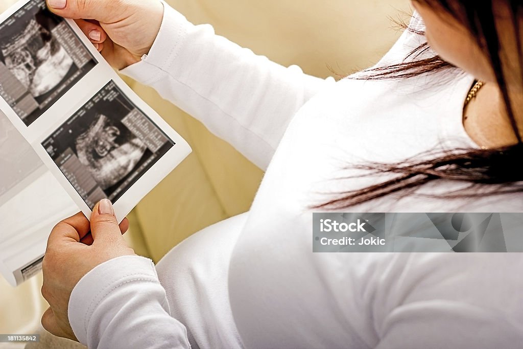 Grávida segurando um sonogram do seu feto. - Royalty-free Exploração Foto de stock