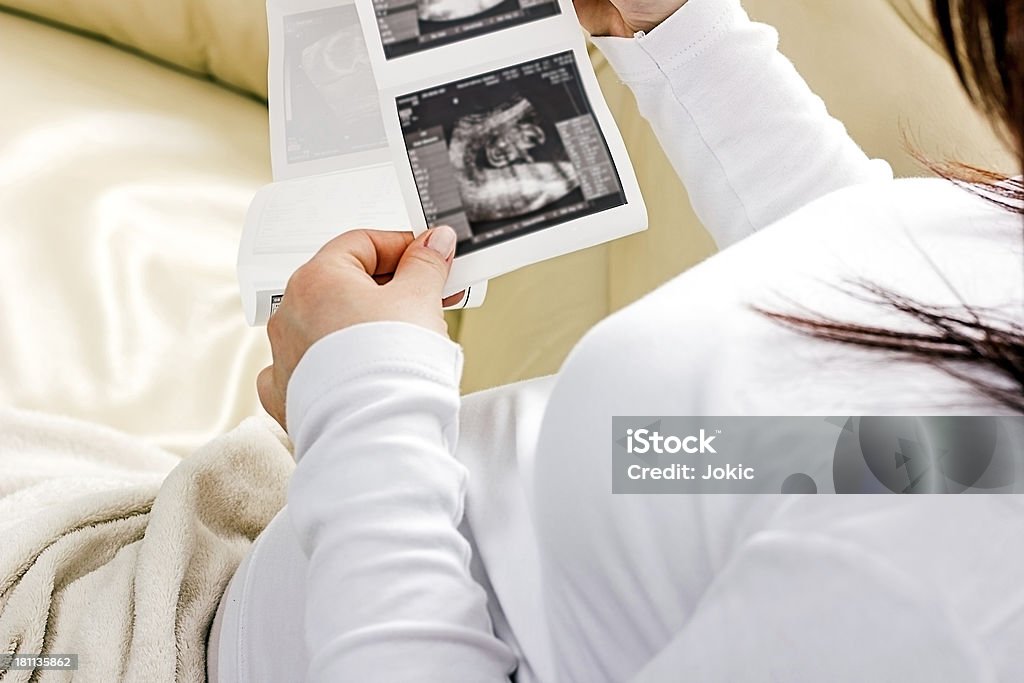 Grávida segurando um sonogram do seu feto. - Royalty-free Documento Imprimido do Computador Foto de stock