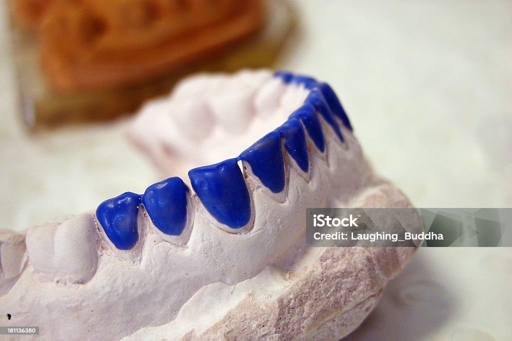 Molde de gesso - Foto de stock de Dente Humano royalty-free